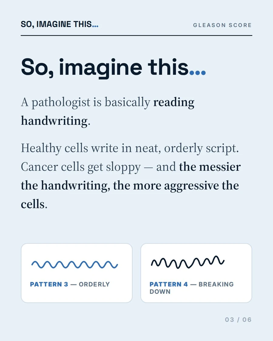 Editorial page using handwriting to make prostate grading easier to understand